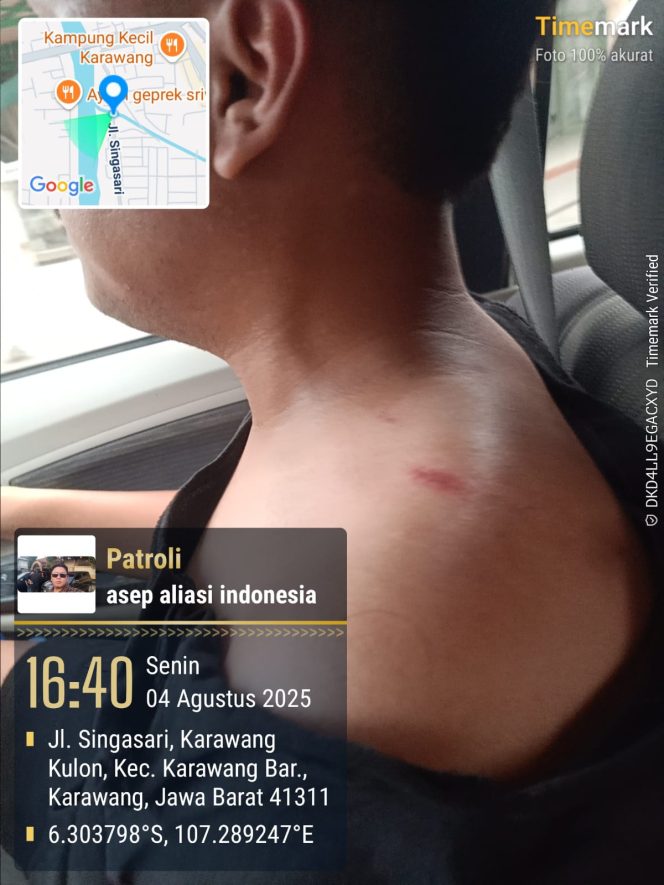 
					Kekerasan Terhadap Jurnalis Kembali Terjadi di Karawang, Riandi Hartono Jadi Korban Pengeroyokan Saat Meliput Dugaan Penjualan Obat Terlarang
